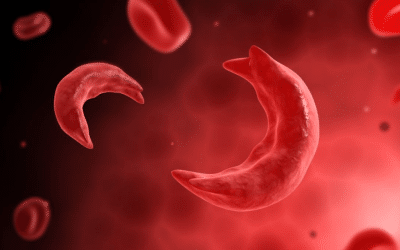 Protected: G6PD and Sickle Cell Disease: Understanding the Connection